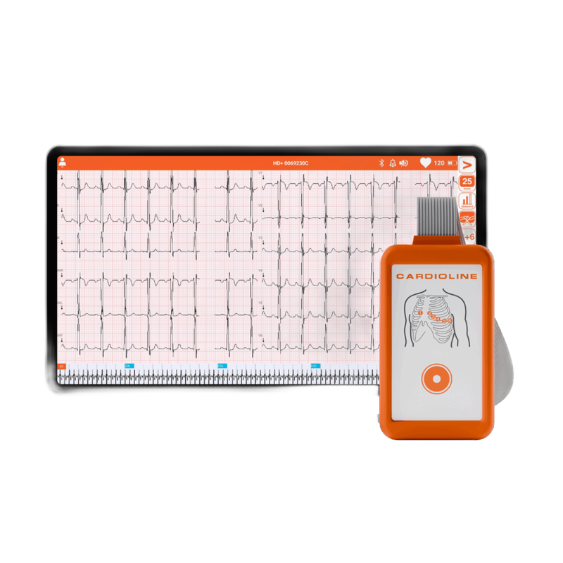 Appareil ECG numérique Cardioline Touch ECG HD+ pour Android – vue principale